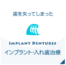インプラント・入れ歯治療